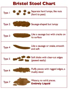 Bristol Stool Chart shows the 7 types of bowel movements to use as a guide when discussing with gastroenterologist in Plano, TX