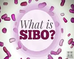 SIBO – Are Bacteria Making Me Bloated?