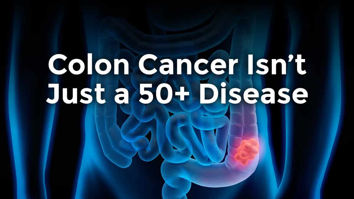 colon cancer is no longer a 50+ disease